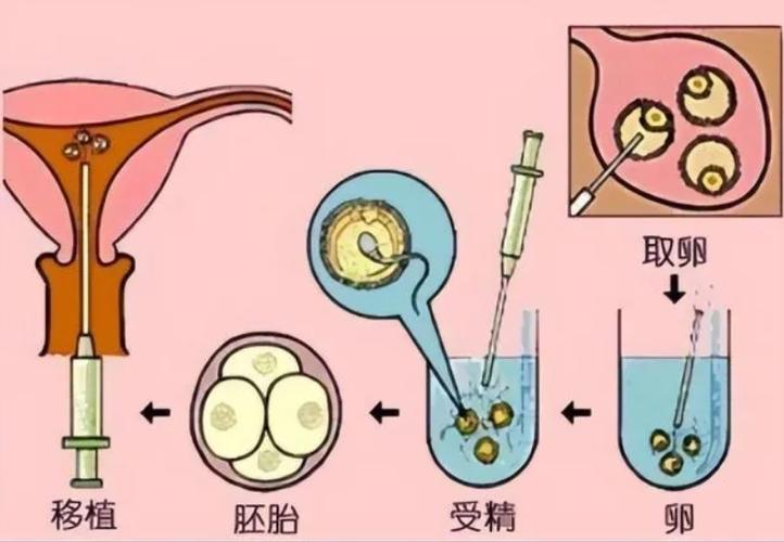 供卵为什么成功率高-供卵成功率高的原因是什么?